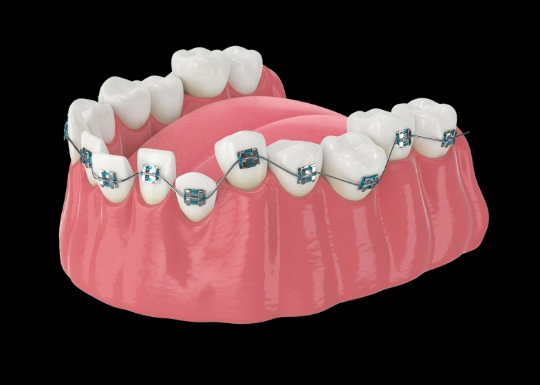 Understanding Orthodontic Care