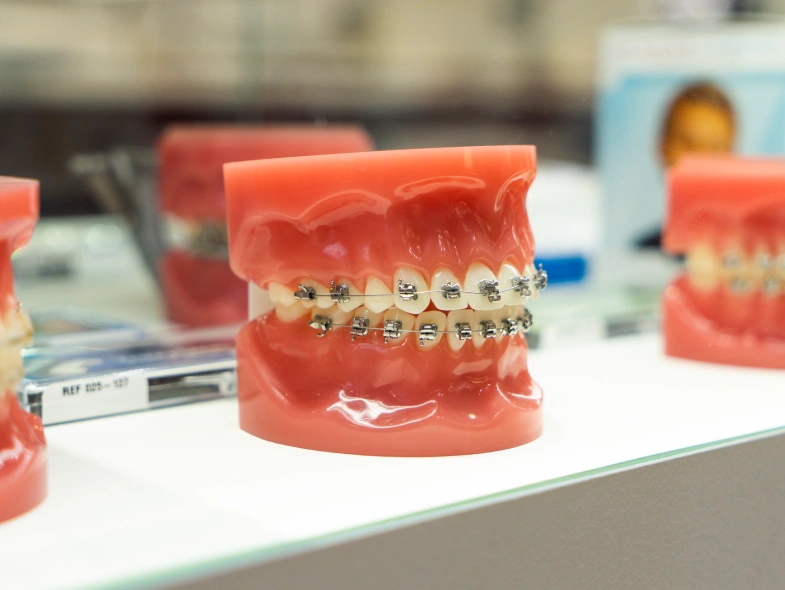 Explore Your Braces Options