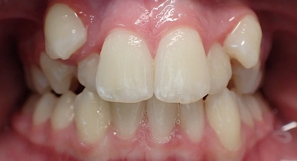 Before 1